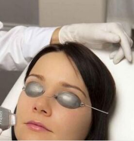 Lasai Laser Gaztetzea
